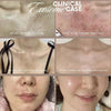 Brandneu aus Korea! K Beauty Exosomen Stammzellen Needeling - VEGAN